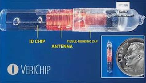 verichip microtransponder mri